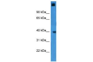 WB Suggested Anti-GTF2A1 Antibody Titration:  0. (GTF2A1 Antikörper  (C-Term))