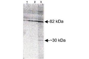 Western blot analysis of Scarb2 in Jurkat whole cell lysate with Scarb2 polyclonal antibody  at different concentration : Lane 1, 1 : 1000. (SCARB2 Antikörper)