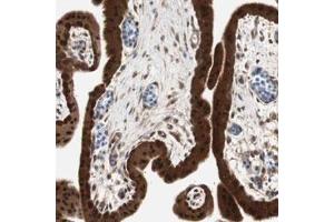 Immunohistochemical staining (Formalin-fixed paraffin-embedded sections) of human placenta with GALT polyclonal antibody  shows strong nuclear and cytoplasmic positivity in trophoblastic cells. (GALT Antikörper)
