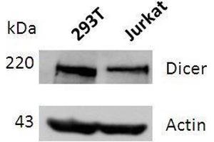 Western blot analysis of DICER expression in lysates of 293T and Jurkat cells. (DICER1 Antikörper  (full length))