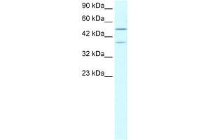 WB Suggested Anti-USP3 Antibody Titration:  0. (USP3 Antikörper  (N-Term))