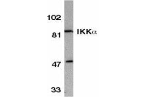 Western blot analysis of IKK alpha in HeLa whole cell lysate with AP30404PU-N IKK alpha antibody at 1/500 dilution. (IKK alpha Antikörper  (C-Term))