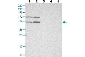 Western blot analysis of Lane 1: RT-4, Lane 2: U-251 MG, Lane 3: Human Plasma, Lane 4: Liver, Lane 5: Tonsil with ZNF642 polyclonal antibody  at 1:250-1:500 dilution. (ZFP69 Antikörper)