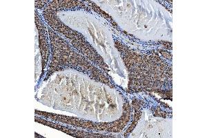IHC analysis of SF3A3 using anti-SF3A3 antibody (ABIN7599863).