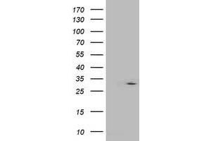 Western Blotting (WB) image for anti-Interferon-Induced Protein 35 (IFI35) antibody (ABIN1498801) (IFI35 Antikörper)