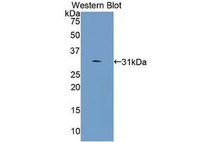 Western blot analysis of the recombinant protein. (COL4a5 Antikörper  (AA 1461-1685))