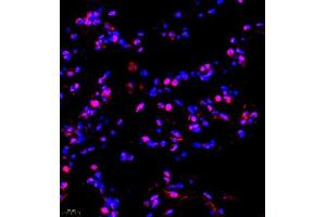 Immunofluorescence of paraffin embedded human lung using TFIIIC110 (ABIN7074038) at dilution of 1:650 (400x lens) (GTF3C2 Antikörper)