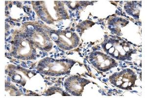 IHC analysis of Clathrin heavy chain/CLTC using anti-Clathrin heavy chain/CLTC antibody (ABIN7602704). (Clathrin Heavy Chain (CLTC) (AA 967-1668) Antikörper)