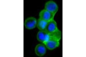 Confocal immunofluorescence analysis of HEK293 cells trasfected with full-length ISL1-hIgGFc using ISL1 mouse mAb (green). (ISL1 Antikörper)