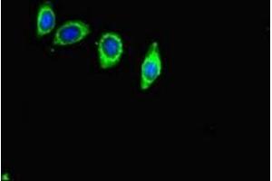 Immunofluorescent analysis of HepG2 cells using ABIN7144126 at dilution of 1:100 and Alexa Fluor 488-congugated AffiniPure Goat Anti-Rabbit IgG(H+L) (ACE2 Antikörper  (AA 395-638))