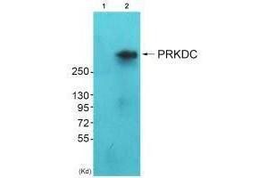 Western blot analysis of extracts from HeLa cells (Lane 2), using DNA-PK antiobdy. (PRKDC Antikörper)
