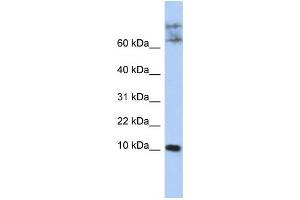 Western Blotting (WB) image for anti-Chemokine-Like Factor (CKLF) antibody (ABIN2459148)