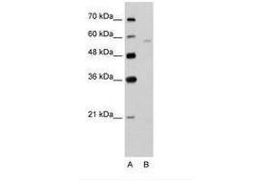 Image no. 2 for anti-Solute Carrier Family 22 (Organic Cation Transporter), Member 7 (SLC22A7) (AA 51-100) antibody (ABIN203433) (SLC22A7 Antikörper  (AA 51-100))
