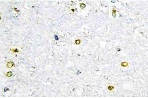Immunohistochemistry (IHC) analyzes of TIF1alpha antibody in paraffin-embedded human brain tissue. (TRIM24 Antikörper)