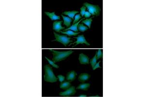 anti-Dynein, Axonemal, Light Chain 1 (DNAL1) (AA 1-190) antibody