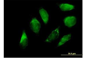 Immunofluorescence of purified MaxPab antibody to SERPINH1 on HeLa cell. (SERPINH1 Antikörper  (AA 1-418))