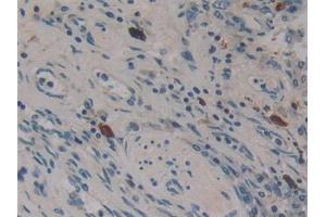 Immunohistochemistry (IHC) image for anti-Dynamin 2 (DNM2) (AA 533-731) antibody (ABIN7433204)