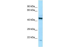 Western Blotting (WB) image for anti-Eukaryotic Translation Initiation Factor 2B, Subunit 2 Beta, 39kDa (EIF2B2) (Middle Region) antibody (ABIN2790211)