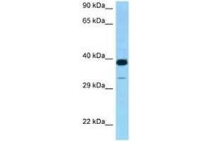 Image no. 1 for anti-Cysteine-Rich with EGF-Like Domains 2 (CRELD2) (AA 135-184) antibody (ABIN6748231) (CRELD2 Antikörper  (AA 135-184))