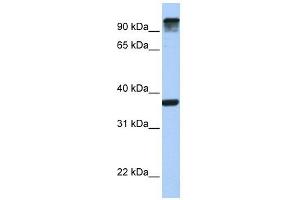 EPS15 antibody used at 1 ug/ml to detect target protein. (EPS15 Antikörper  (C-Term))