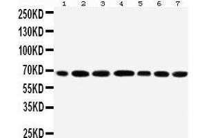 Anti-DDX5 antibody, Western blotting All lanes: Anti DDX5  at 0. (DDX5 Antikörper  (C-Term))