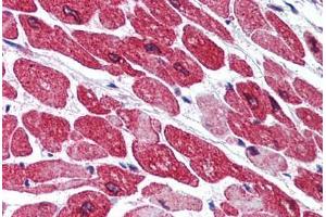 Human Heart (formalin-fixed, paraffin-embedded) stained with AOF2 antibody ABIN290327 at 5 ug/ml followed by biotinylated goat anti-rabbit IgG secondary antibody ABIN481713, alkaline phosphatase-streptavidin and chromogen. (LSD1 Antikörper  (AA 100-150))