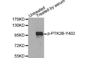 Western blot analysis of extracts from 293 cells, using Phospho-PTK2B-Y402 antibody (ABIN2987623).