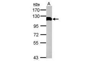 Image no. 1 for anti-Ubiquitin Specific Peptidase 13 (Isopeptidase T-3) (USP13) (C-Term) antibody (ABIN1491928) (USP13 Antikörper  (C-Term))