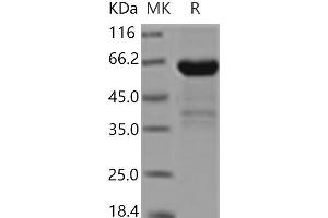 Western Blotting (WB) image for Fc Fragment of IgE, Low Affinity II, Receptor For (CD23) (FCER2) protein (Fc Tag) (ABIN7195671) (FCER2 Protein (Fc Tag))