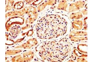 Immunohistochemistry (IHC) image for anti-Nuclear Factor of Activated T-Cells, Cytoplasmic, Calcineurin-Dependent 3 (NFATC3) (AA 887-1070) antibody (ABIN7161797)
