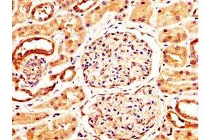 IHC image of ABIN7161797 diluted at 1:400 and staining in paraffin-embedded human kidney tissue performed on a Leica BondTM system. (NFATC3 Antikörper  (AA 887-1070))
