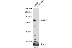 Western blot analysis of extracts from normal (control) and MMP13 knockout (KO) 293T cells, using MMP13 antibody (ABIN7268418) at 1:1000 dilution. (MMP13 Antikörper  (AA 262-471))