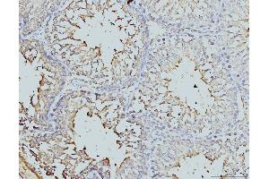 IHC analysis of DDX4/MVH using anti-DDX4/MVH antibody (ABIN7601204).