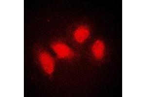 Immunofluorescent analysis of SMG7 staining in A431 cells.