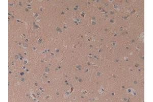 IHC-P analysis of Human Brain Tissue, with DAB staining. (CYLD Antikörper  (AA 170-338))