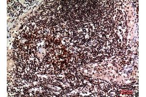 Immunohistochemistry (IHC) analysis of paraffin-embedded Human Lymph, antibody was diluted at 1:100. (2B4 Antikörper  (Internal Region))