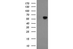 Western Blotting (WB) image for anti-Formiminotransferase Cyclodeaminase (FTCD) antibody (ABIN1496378) (FTCD Antikörper)