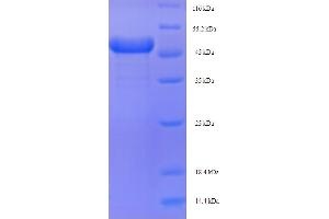 SDS-PAGE (SDS) image for Arginase, Type II (ARG2) (AA 23-354) protein (His-SUMO Tag) (ABIN5709077)