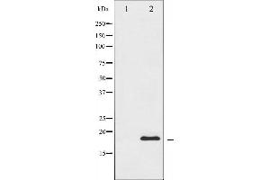 Western blot analysis of CHOP expression in HeLa whole cell lysates,The lane on the left is treated with the antigen-specific peptide. (DDIT3 Antikörper  (N-Term))