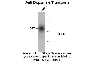 Western blot of Dopamine Transporter C-Terminus Human Antibody Western Blot of Rabbit Anti-Dopamine Transporter C-Terminus Human Antibody. (SLC6A3 Antikörper  (C-Term))