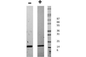 SDS-PAGE of Mouse CD40 Ligand Recombinant Protein SDS-PAGE of Mouse CD40 Ligand Recombinant Protein.