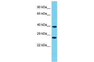 Host: Rabbit Target Name: FBXO44 Sample Type: Fetal Heart lysates Antibody Dilution: 1.