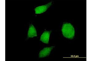Immunofluorescence of purified MaxPab antibody to PHF17 on HeLa cell. (PHF17 Antikörper  (AA 1-509))