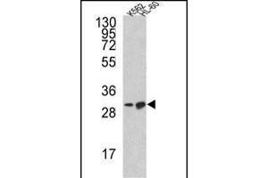 Western blot analysis of BCL2L11 Antibody (Center) (ABIN652493 and ABIN2842332) in K562, HL-60 cell line lysates (35 μg/lane).