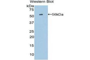 Western Blotting (WB) image for anti-Proopiomelanocortin (POMC) (AA 27-235) antibody (ABIN1860275)