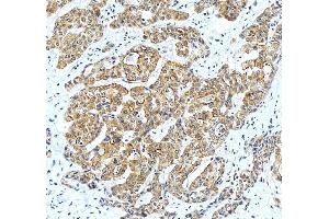 IHC analysis of LIGHT/TNFSF14 using anti-LIGHT/TNFSF14 antibody (ABIN7599138).