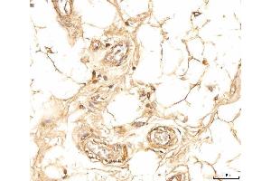 IHC analysis of EIF4B using anti-EIF4B antibody (ABIN7599496). (EIF4B Antikörper  (AA 1-611))