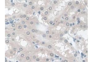 IHC-P analysis of Rat Kidney Tissue, with DAB staining. (TPSB2 Antikörper  (AA 30-274))