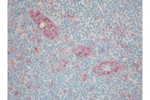 Image no. 1 for anti-serpin Peptidase Inhibitor, Clade A (Alpha-1 Antiproteinase, Antitrypsin), Member 3 (SERPINA3) antibody (ABIN379996) (SERPINA3 Antikörper)
