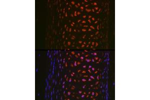 Immunofluorescence analysis of rat trachea using MMP13 Rabbit pAb (ABIN7268418) at dilution of 1:100 (40x lens). (MMP13 Antikörper  (AA 262-471))